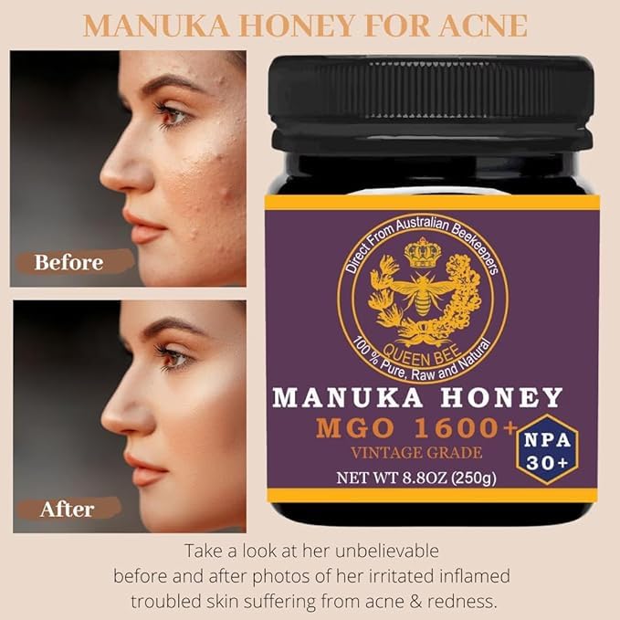 Manuka Honey MGO 1600+ NPA 30+ High Strength Medical Grade - Raw Manuka Honey (250g/8.8 ounce)