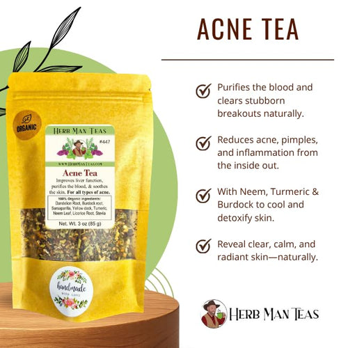 ACNE TEA – Organic Herbal Blend to Support Clear Skin &amp Complexion – Formulated by Master Herbalist Khabir – 100% Organic Non-GMO No Additives
